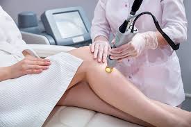 Embrace Effortless Beauty: Say Goodbye to Unwanted Hair with Laser Hair Removal post thumbnail image