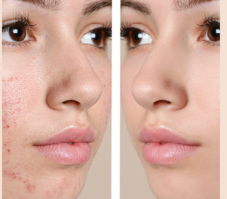Skincare Convenience: Finding the Right Skin Specialist Near Me post thumbnail image